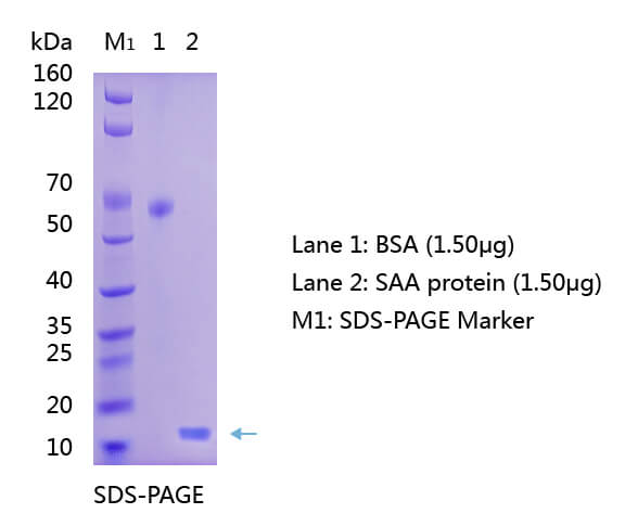 SAA SDS-PAGE SAA SDS-PAGE